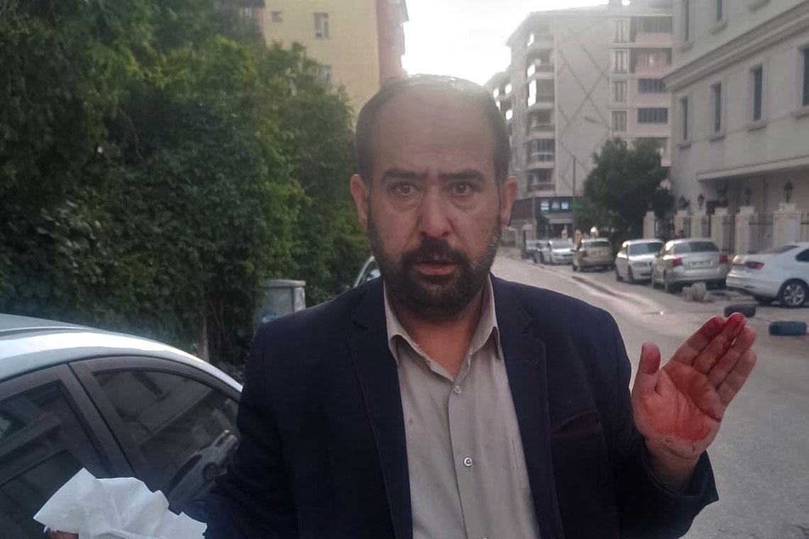 Van’da yumruklu saldırıya uğrayan gazeteci Yasin İpek: &quot;Birilerinin yönlendirdiğini düşünüyorum”