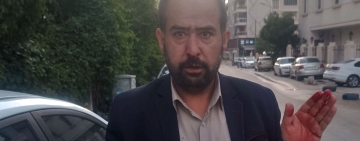 Van’da yumruklu saldırıya uğrayan gazeteci Yasin İpek:
